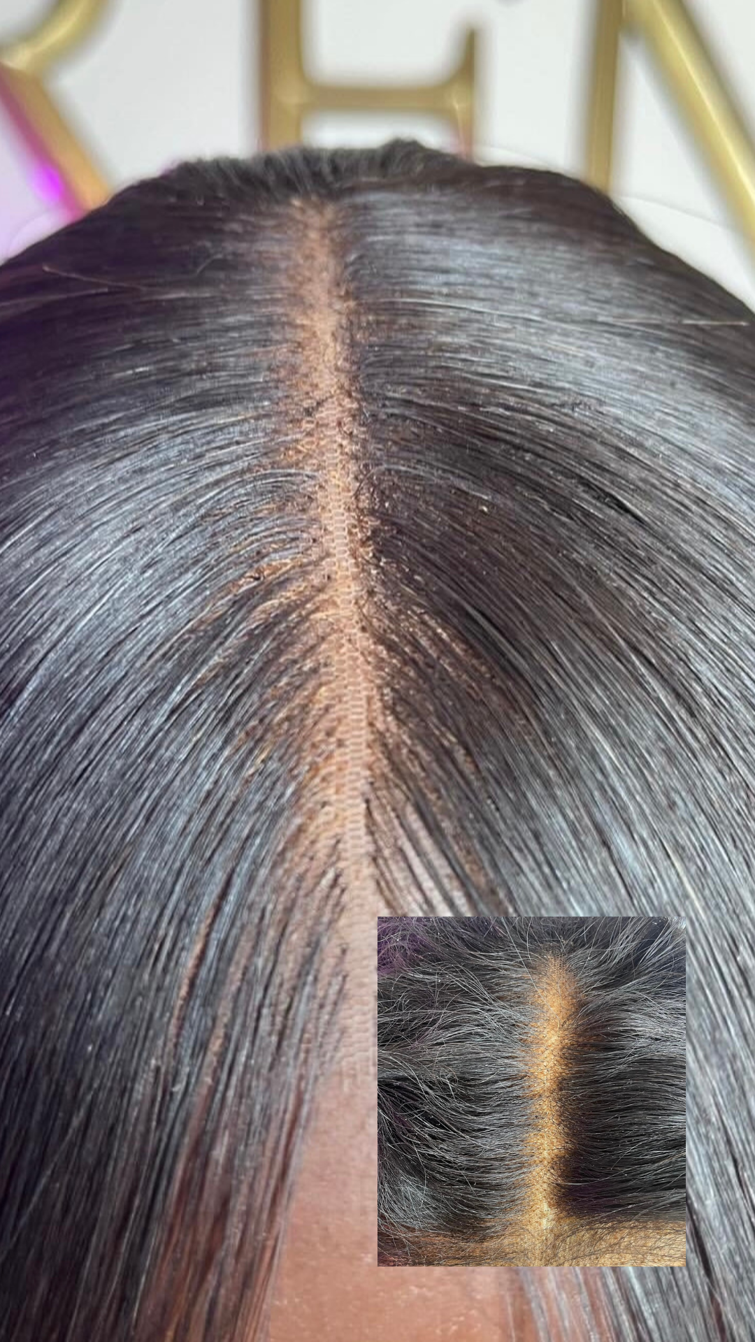 Wig Rehab
